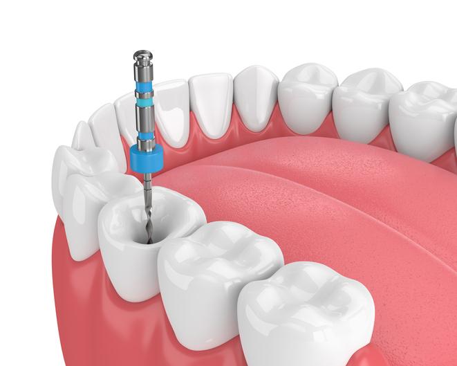 endodoncja